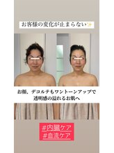 シファ(SHIFA)/美肌、トーンUP、小顔になれる