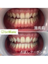 ルブラン 奈良店(Le Blanc)/笑顔に自信を！