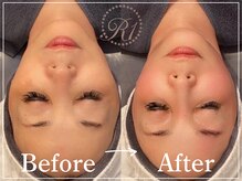 R-1ビューティーサロン 表参道/Before＆After