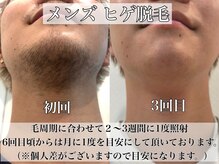 ベルバイグレイス(BELLE by grace)の雰囲気（最新機器THR脱毛☆効果を早くに実感できます【足利脱毛サロン】）