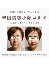 ヌナ(nuna)/小顔コルギ