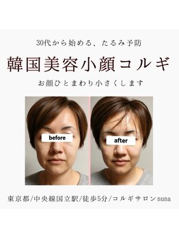 ヌナ(nuna)/小顔コルギ