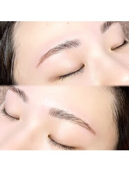 マドンナリリー(Madonna Lily)/お顔の印象を変えるHBL