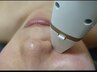 【毛穴撲滅陶器肌コース】フラクショナルRF全顔　毛穴、ニキビ後の赤み改善