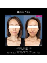 ドルチェビューティーサロン 戸塚安行店(Dolce Beauty Salon)/エイジングケアFacial_施術3回