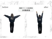 トキ(TOKI)/筋膜リリース美容整体　施術後
