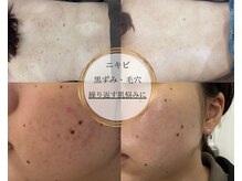 エレナ(ELENA)の雰囲気（【お悩みに合わせて】あなただけのオーダーメイド施術）