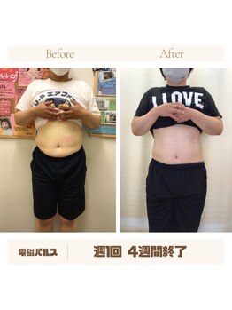 三篠北町整骨院/電磁パルスダイエット