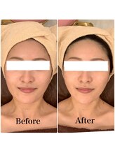 スペチアーレ 夙川/無制限ハイリフで驚きの変化