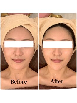 スペチアーレ 夙川/無制限ハイリフで驚きの変化