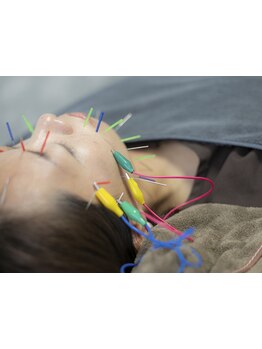 鍼灸施術を受けたい