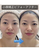 シェリスパ(Cheri Spa)/東京都ランキングタラソ5位獲得!