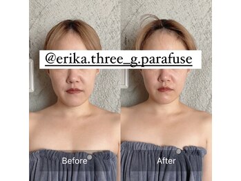 スリージー/before/after