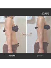 ナチュラ(Natura)/バザルトストーンで姿勢も改善！