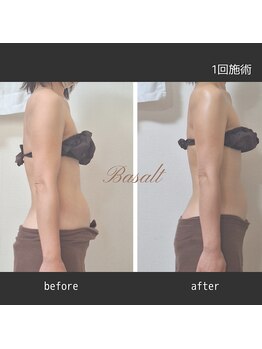 ナチュラ(Natura)/バザルトストーンで姿勢も改善!