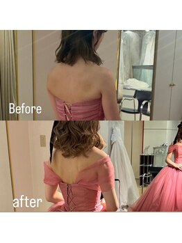 美容整骨小顔ラボ/ブライダル　ビフォーアフター