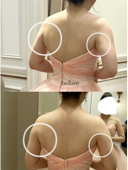 アリーズ エステ スウェイ(ally's esthe sway)/ドレス映えの決め手は後ろ姿