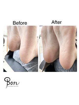 ネイルアトリエ ボン(nail atelier bon)/足裏角質ケア