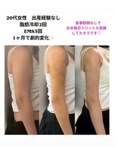 スリム(SLIM by lily of the valley)/劇的に痩せてますね