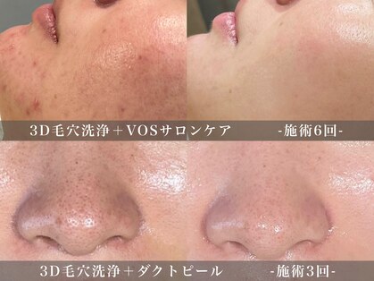 ゼアー(THERE FY.)の写真