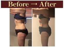 グレースフルタイム プレミアム(Graceful Time PREMIUM)/ビフォーアフター