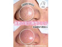 エメ(Aimer)の雰囲気（シミケア/ニキビケア/艶肌/くすみ解消/肌質改善エステ）