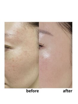 サリューベ(SALUDBE)の写真/お疲れ肌脱却へ。美肌に導く幹細胞培養美容液と濃厚美肌成分カクテルで艶を纏う♪