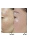 サリューベ(SALUDBE)の写真/お疲れ肌脱却へ。美肌に導く幹細胞培養美容液と濃厚美肌成分カクテルで艶を纏う♪
