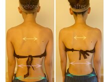 パル コルギサロン(Pal. Korugi salon)/コルギビフォーアフター