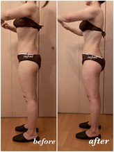 アンフィニ(infini)/短期集中全身コース5回（2ヶ月）