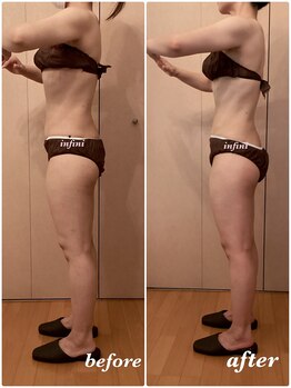 アンフィニ(infini)/短期集中全身コース5回(2ヶ月)