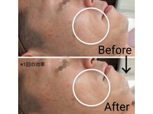 エステサロン リブル(LIBRE)の雰囲気（どのコースも、1回で変化に気付いていただけます）