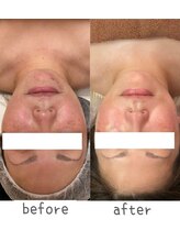 トモズサロン28(Tomos.salon.)/老化トラブル全般に！