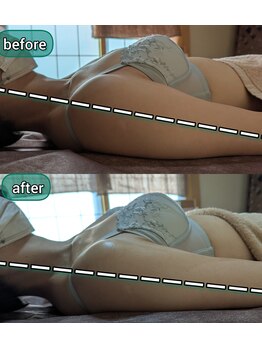 スノードロップ(snowdrop)/バストアップは巻き肩改善付き