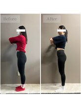 ルシェアプラス(LUSHARE+)/ヒップアップも叶えます