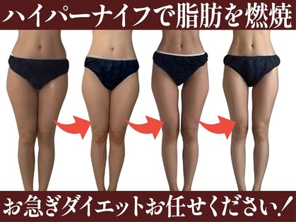 エムプリュ(M.plus)の写真