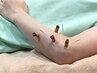 【肩・ひじなどの痛みに】鍼灸＋超音波施術（上肢）45分　¥5,000→¥4,500