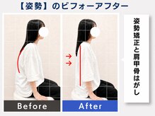 ウェルメディカル 豊中駅前整体院/整体×姿勢矯正【肩こり/腰痛】