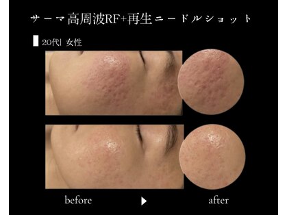 プレジール(Plaisir)の写真