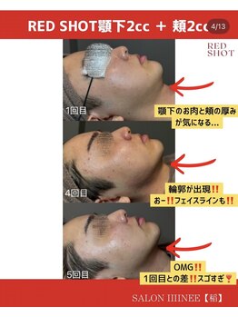 サロン 稲(SALON IIIINEE)/レッドショットの破壊力☆