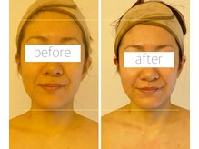 パル コルギサロン(Pal. Korugi salon)/コルギビフォーアフター