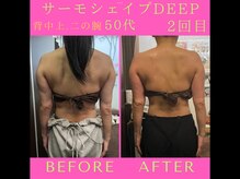 リラクゼーションサロン ラキ(laki)/サーモシェイプDEEP2回50代/痩身