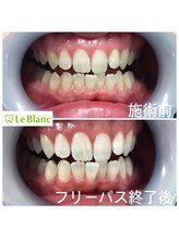 ルブラン 奈良店(Le Blanc)/歯は人それぞれ違います。
