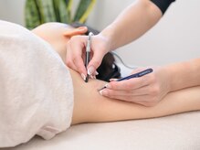 リリン 川崎 蒲田(RIRiN)/ 脇脱毛