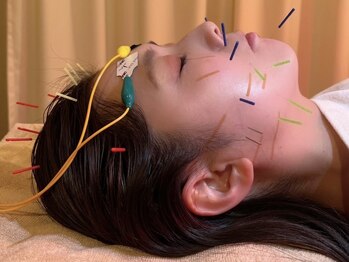 茶ノ木鍼灸整骨院/美容鍼 美肌トリートメント