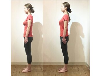 松山美容整体院/（４０歳代）　施術例