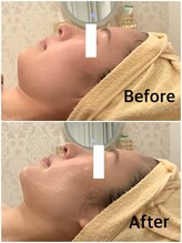 スペチアーレ 夙川/引き上がり＆美肌GET