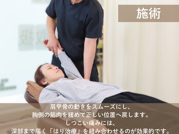 みずえ駅ビル整骨院/肩こりの施術　瑞江/整体/鍼灸