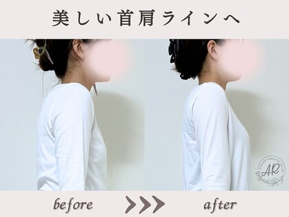 エーアール(AR)の写真