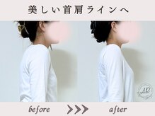 エーアール(AR)